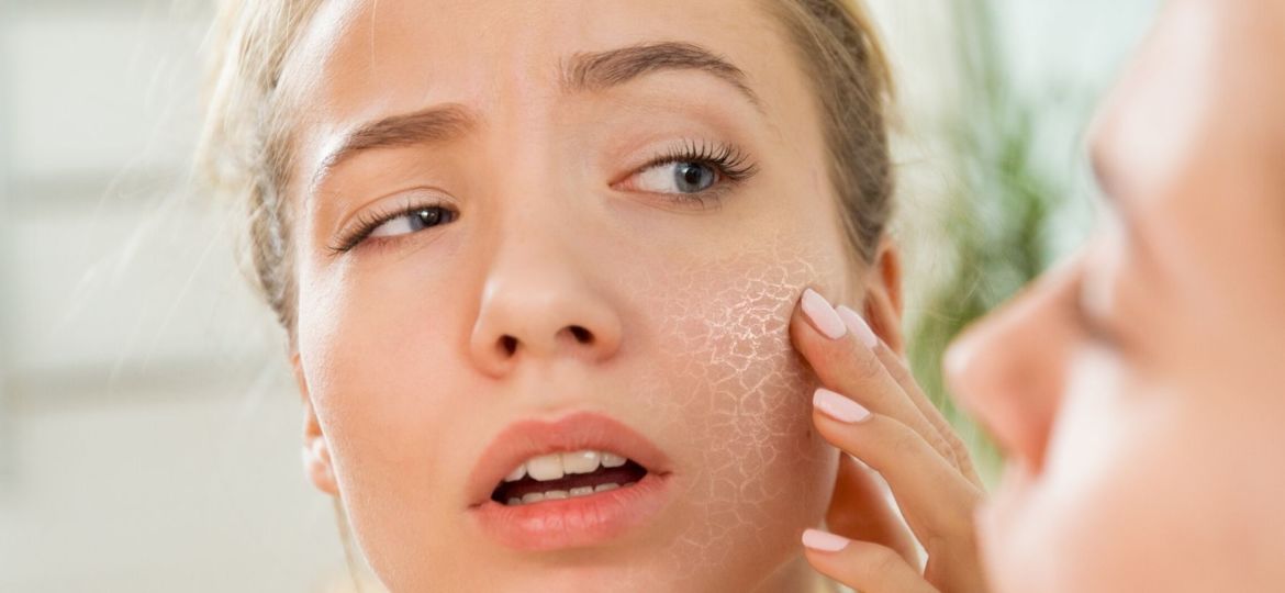 benzoyl peroxide and why you should avoid it Holistic Lifestyle by Leigh Ann Lindsey